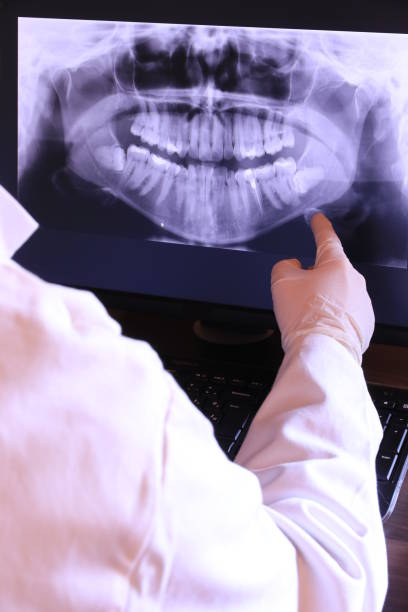 Best Emergency Gum Treatment in Hurlock, MD