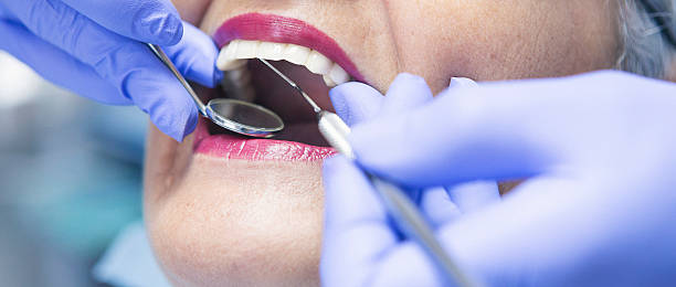Best Urgent Care for Lost Fillings or Crowns in Hurlock, MD